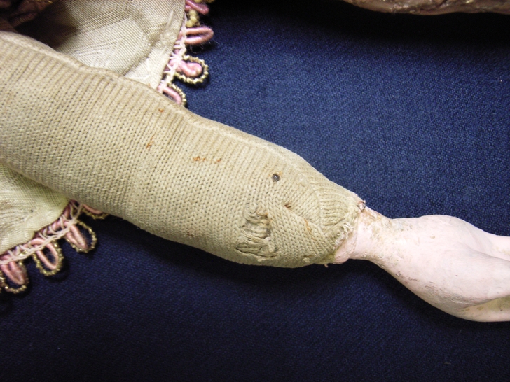 Braccio destro prima del restauro